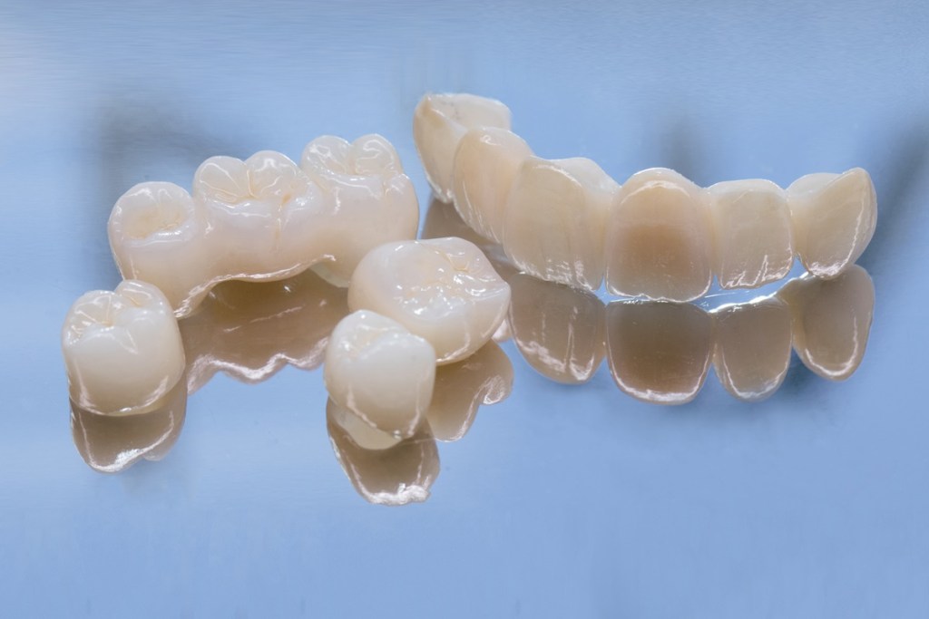 How Different Materials Affect Your Dental Restoration