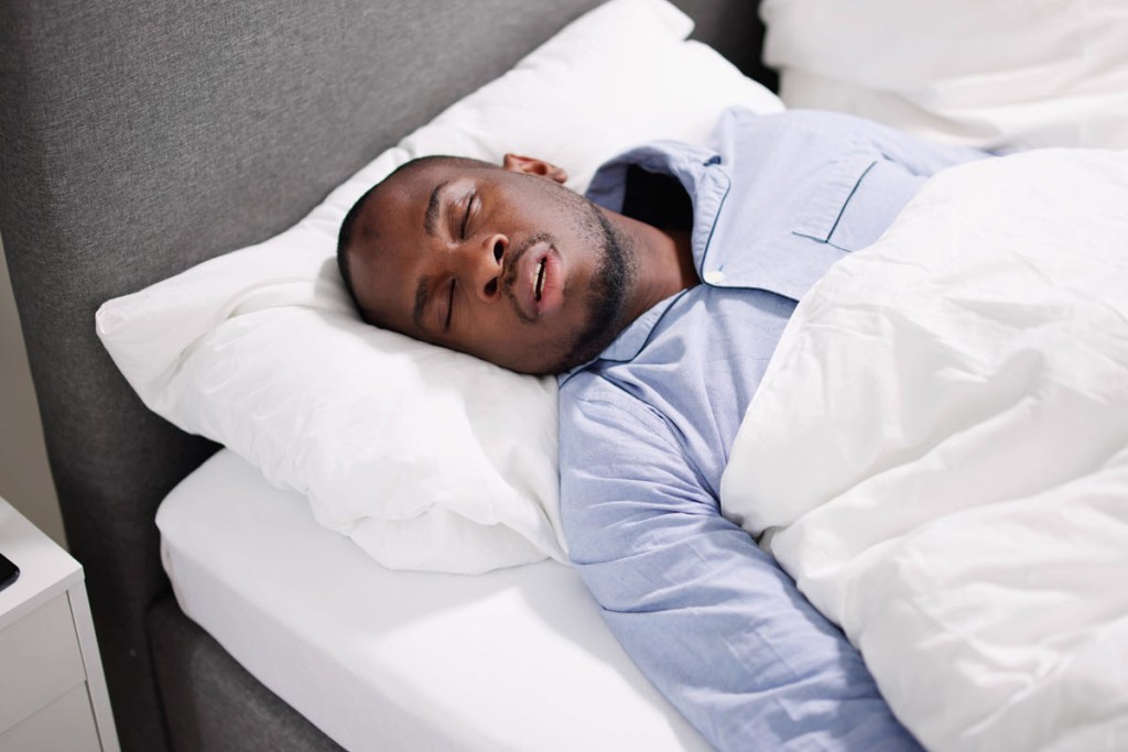 How Sleep Apnea Impacts Your Oral Health