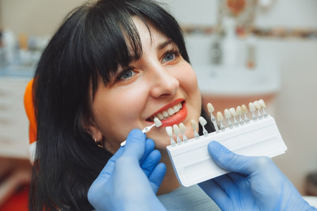 Is a Full Smile Makeover Worth Getting?